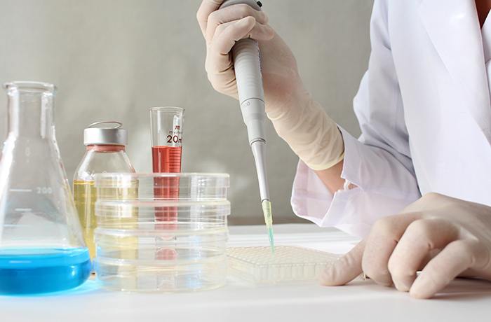 In bestimmten Stadien einer Dysplasie können Biomarker zeigen ob sich ein Befund wahrscheinlich verschlimmert oder von selbst heilt. Arm und Hand mit weißem Gummihandschuh und Labor-Pipette, Glasflaschen mit blauer, gelber und roter Flüssigkeit, Laborschalen aus Glas